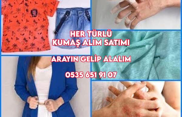 Bebeklerde kıyafet alerjisi, Kıyafet alerjisi belirtileri, Kıyafet alerjisi nasıl geçer, Kumaş alerjisi belirtileri, Kumaş alerjisi tedavisi, Pamuk alerjisi belirtileri, Polyester alerjisi